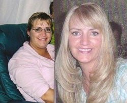 Jill Knap before and after weight loss